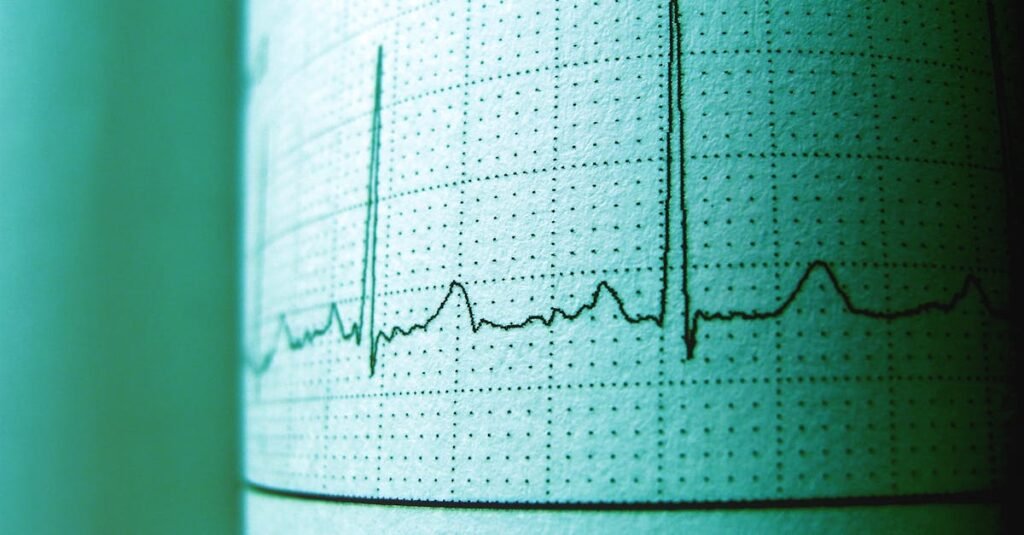 heart rhythm signals