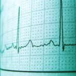 heart rhythm signals