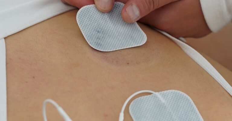 vagus nerve stimulation Alzheimer's